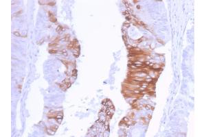 Image no. 2 for anti-Keratin 20 (KRT20) (AA 196-323) antibody (ABIN6940352)