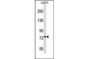 Image no. 1 for anti-Procollagen-Lysine,2-Oxoglutarate 5-Dioxygenase 1 (PLOD1) (AA 73-102), (N-Term) antibody (ABIN954205)