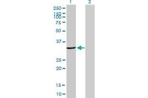 Image no. 1 for anti-Deoxycytidine Kinase (DCK) (AA 1-260) antibody (ABIN514889)