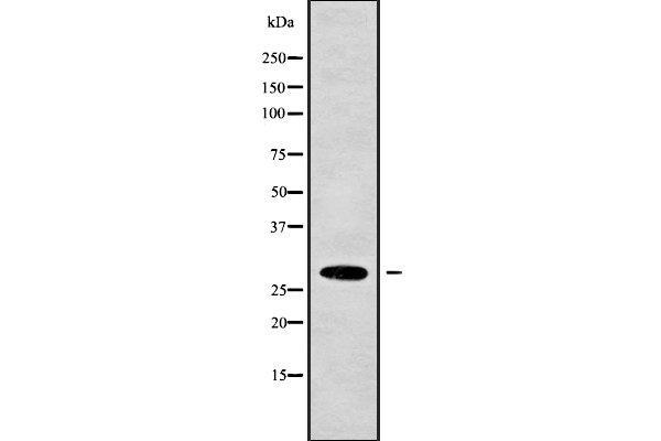HUS1B antibody  (Internal Region)