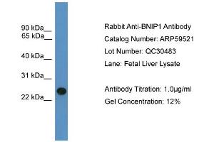 Image no. 2 for anti-BCL2/adenovirus E1B 19kDa Interacting Protein 1 (BNIP1) (C-Term) antibody (ABIN2788100)