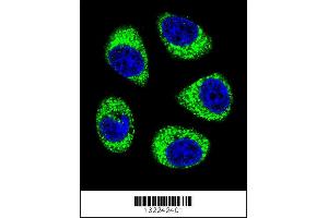 Image no. 1 for anti-Solute Carrier Family 25 (Mitochondrial Carrier, Adenine Nucleotide Translocator), Member 6 (SLC25A6) (AA 128-155) antibody (ABIN656122)