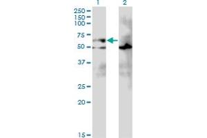 Western Blot analysis of EIF2A expression in transfected 293T cell line by EIF2A monoclonal antibody (M01), clone 3D5.