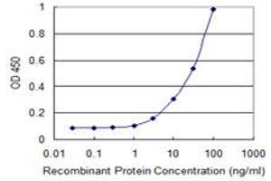 anti-Protein-O-Mannosyltransferase 2 (POMT2) (AA 483-580) antibody