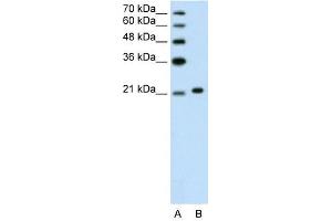 Image no. 3 for anti-Ankyrin 1, Erythrocytic (ANK1) (C-Term) antibody (ABIN630429)