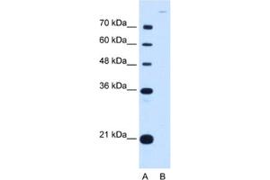 Image no. 1 for anti-Cadherin 7 (CDH7) antibody (ABIN2462981)