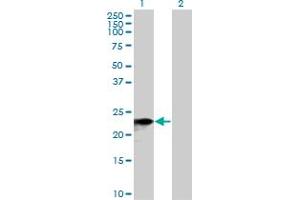 Image no. 1 for anti-Sorting Nexin 10 (SNX10) (AA 1-201) antibody (ABIN526140)
