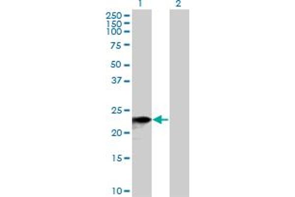 SNX10 antibody  (AA 1-201)