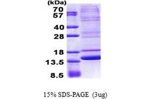 Neuromedin B Protein (AA 25-121) (His tag)