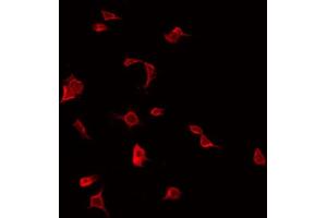 Image no. 3 for anti-Interleukin 1 Receptor Accessory Protein-Like 2 (IL1RAPL2) antibody (ABIN6262523)