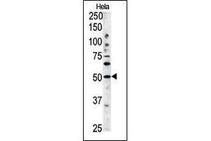 Image no. 2 for anti-Autophagy related 4C Cysteine Peptidase (ATG4C) (AA 167-196) antibody (ABIN1882159)