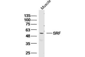 SRF antibody  (AA 101-250)