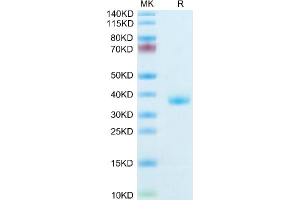 IGFBP2 Protein (His tag)