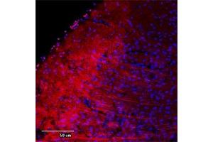 Image no. 6 for anti-Microtubule-Associated Protein 2 (MAP2) (AA 350-400) antibody (ABIN350476)