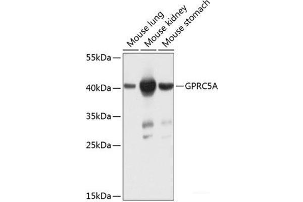 GPRC5A anticorps