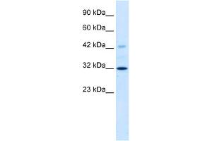 anti-Voltage-Dependent Anion Channel 1 (VDAC1) (C-Term) antibody