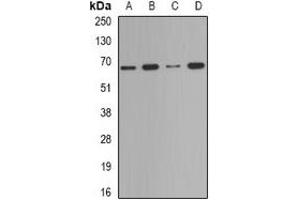 Image no. 2 for anti-Deltex Homolog 2 (DTX2) antibody (ABIN2966566)