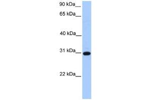 Image no. 1 for anti-Electron-Transfer-Flavoprotein, beta Polypeptide (ETFB) (C-Term) antibody (ABIN2785714)