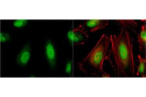 ICC/IF Image VHL antibody detects VHL protein at cytoplasm and nucleus by immunofluorescent analysis.