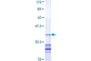 Image no. 1 for Actin Related Protein 2/3 Complex, Subunit 3, 21kDa (ARPC3) (AA 79-178) protein (GST tag) (ABIN1345693)