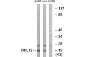 Image no. 1 for anti-Ribosomal Protein L12 (RPL12) (AA 61-110) antibody (ABIN1534555)
