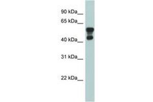 Image no. 1 for anti-Platelet-Activating Factor Acetylhydrolase 1b, Regulatory Subunit 1 (45kDa) (PAFAH1B1) (AA 71-120) antibody (ABIN6743973)