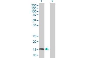Image no. 1 for anti-Aspartyl Aminopeptidase (DNPEP) (AA 1-164) antibody (ABIN525242)