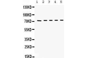 Image no. 1 for anti-Kininogen 1 (KNG1) (AA 227-259), (Middle Region) antibody (ABIN3043285)