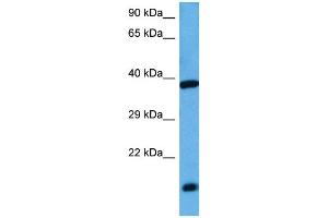 Image no. 4 for anti-Activating Transcription Factor 4 (Tax-Responsive Enhancer Element B67) (ATF4) (N-Term) antibody (ABIN2780377)