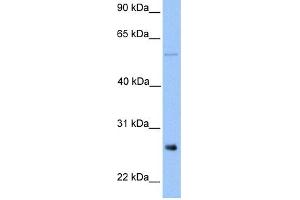 Image no. 1 for anti-Methyltransferase Like 7B (METTL7B) (Middle Region) antibody (ABIN2783628)