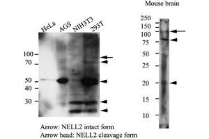Image no. 2 for anti-NEL-Like 2 (Chicken) (NELL2) antibody (ABIN614304)