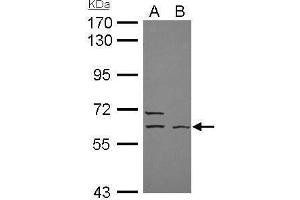Image no. 2 for anti-Elongator complex protein 3 (ELP3) (Center) antibody (ABIN2854617)
