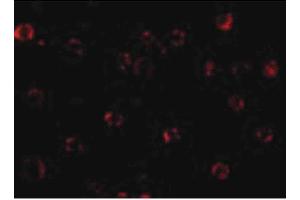 Image no. 2 for anti-NLR Family, Apoptosis Inhibitory Protein (NAIP) (C-Term) antibody (ABIN6655432)