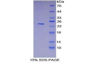 Image no. 1 for HLA Class II DR alpha (HLA-DRA) protein (ABIN3010607)