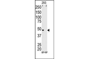 Image no. 2 for anti-Melanoma Antigen Family A, 11 (MAGEA11) (N-Term) antibody (ABIN358642)