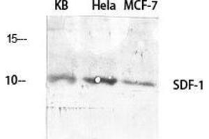 Image no. 2 for anti-Chemokine (C-X-C Motif) Ligand 12 (CXCL12) (C-Term) antibody (ABIN3186887)