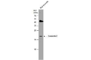 Image no. 4 for anti-Caveolin 2 (CAV2) (N-Term) antibody (ABIN2856589)