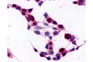Image no. 3 for anti-CD97 (CD97) (N-Term) antibody (ABIN1048416)