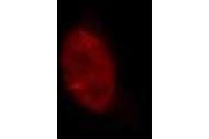 Immunofluorescence (IF) image for anti-Lysine (K)-Specific Demethylase 5A (KDM5A) (AA 1416-1434) antibody (ABIN3201015)