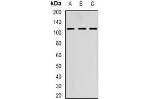 Image no. 1 for anti-Alanyl-tRNA Synthetase 2, Mitochondrial (AARS2) (full length) antibody (ABIN6004498)