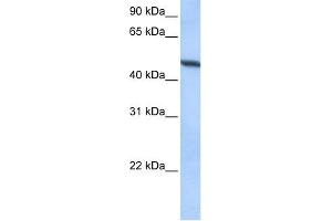Image no. 1 for anti-ADAM Metallopeptidase Domain 33 (ADAM33) (Middle Region) antibody (ABIN2783975)