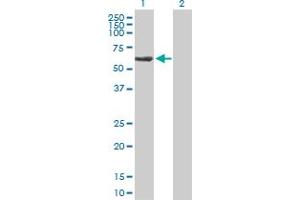 Image no. 1 for anti-Tubulin Folding Cofactor E (TBCE) (AA 1-527) antibody (ABIN520724)