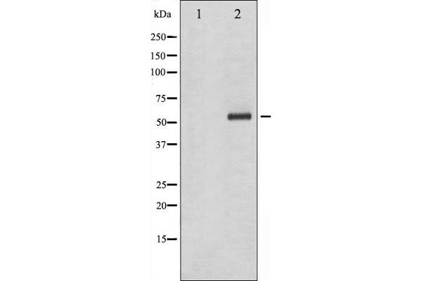 CHEK1 anticorps  (pSer286)
