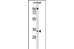 Image no. 1 for anti-UBX Domain Protein 8 (UBXN8) (AA 59-87), (N-Term) antibody (ABIN5537720)