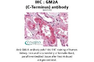 Image no. 1 for anti-GM2 Ganglioside Activator (GM2A) (C-Term) antibody (ABIN1734833)
