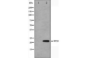 RPS9 antibody  (Internal Region)