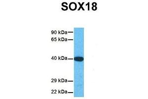 Image no. 5 for anti-SRY (Sex Determining Region Y)-Box 18 (SOX18) (Middle Region) antibody (ABIN2777725)