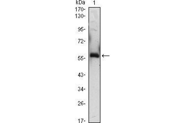 anti-alpha-1-B Glycoprotein (A1BG) antibody