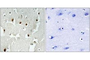Image no. 1 for anti-Transcriptional Regulating Factor 1 (TRERF1) (AA 1071-1120) antibody (ABIN1534076)