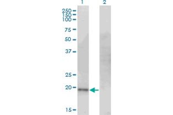 anti-Cysteine Dioxygenase, Type I (CDO1) (AA 101-200) antibody